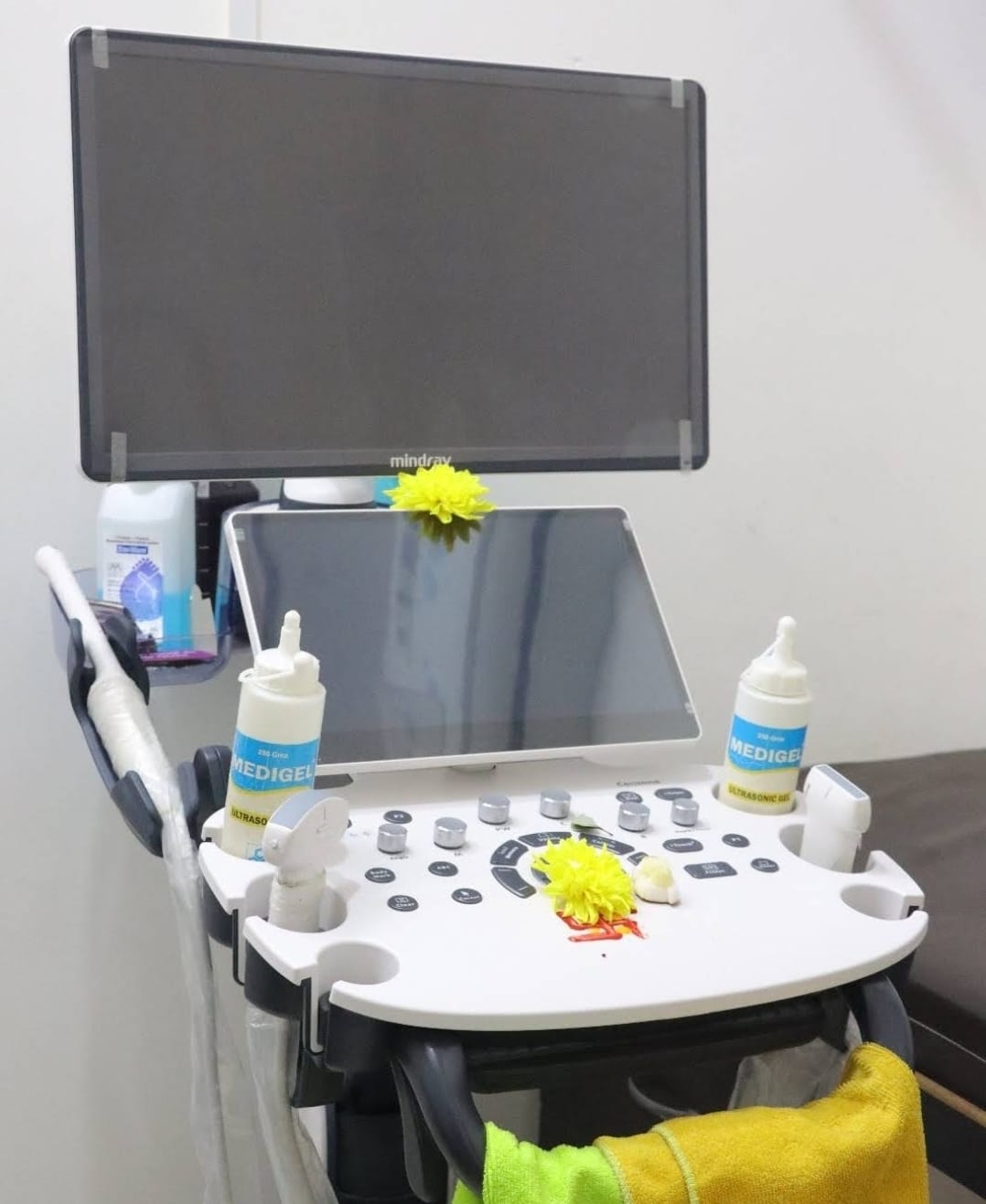 SONOGRAPHY DURING PREGNANCY